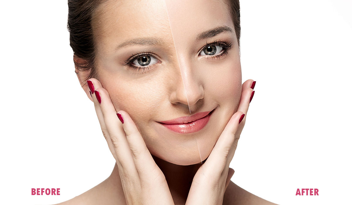 Overview and Advantages of Skin Needling