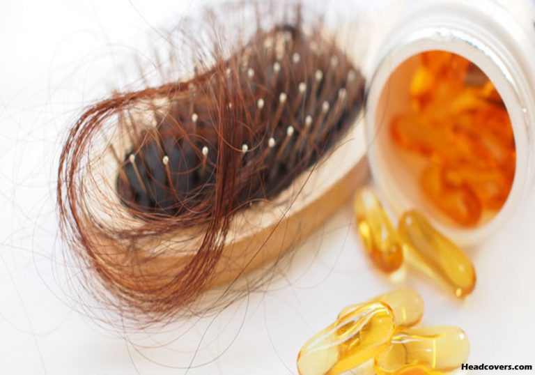 Effective Vitamins For Hair Loss in Women – Stop Thinning by Treating Vitamin Deficiencies