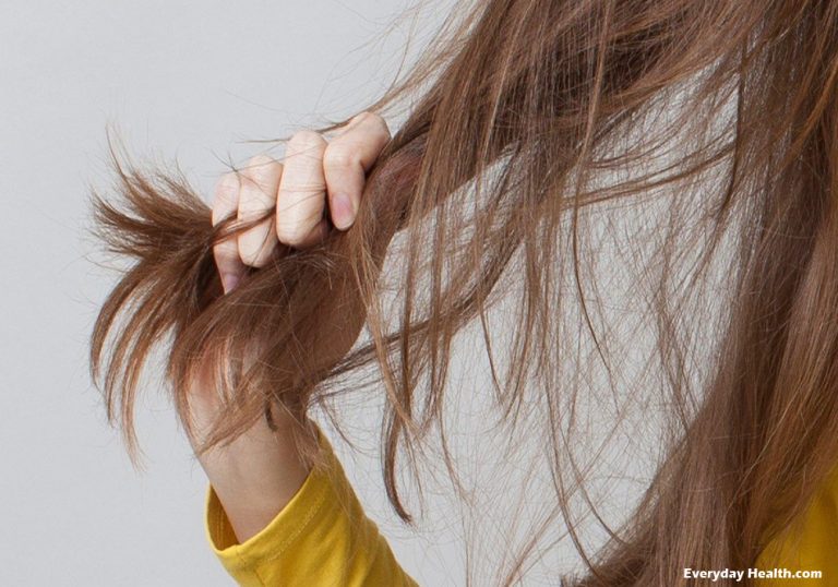 Hair Loss and How It Affects Your Life