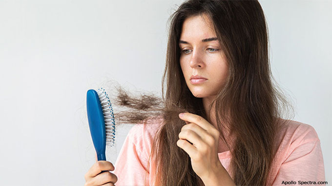 Healthier Suggestions to avoid Hair Loss for Ladies